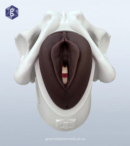Lily - Levator Ani Muscle Avulsion Model