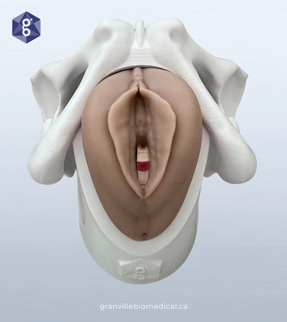 Lily - Levator Ani Muscle Avulsion Model
