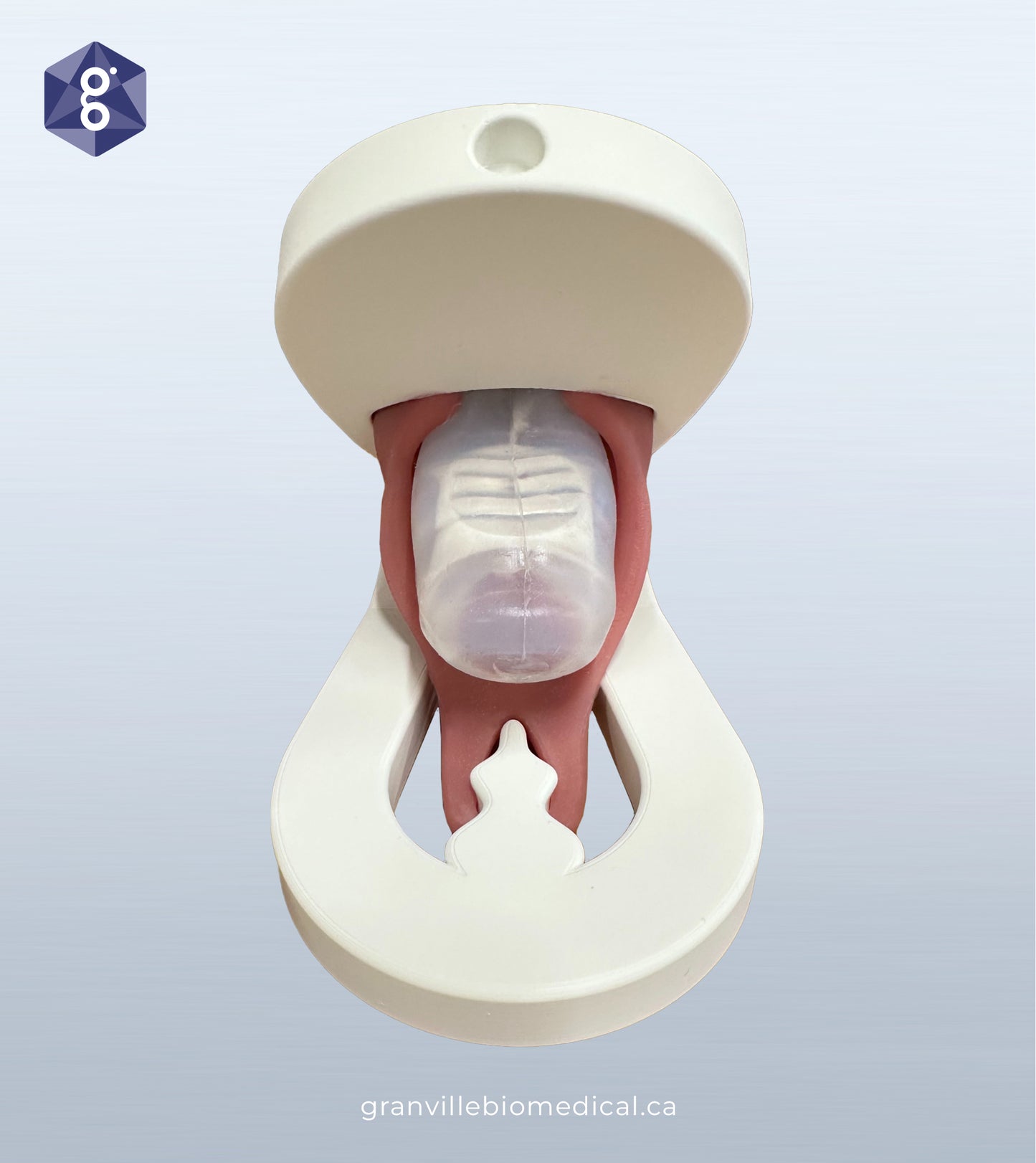 Lily - Levator Ani Muscle Avulsion Model