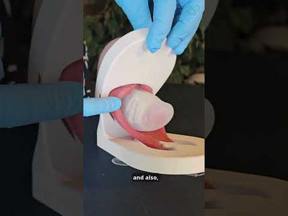 Lily - Levator Ani Muscle Avulsion Model